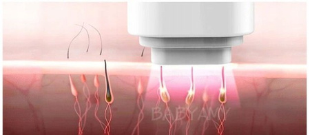 DEPILATOR DO WŁOSÓW CIAŁA LASEROWY BIKINI NÓG DEPILACJA BEZBOLESNY IYOUNG