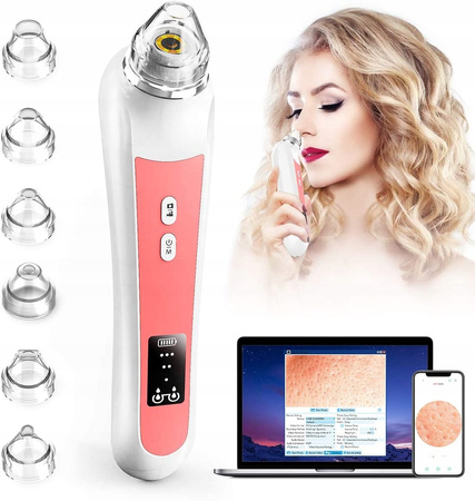 ODKURZACZ DO USUWANIA ZASKÓRNIKÓW WĄGRÓW Z KAMERĄ