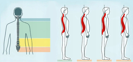 KOREKTOR WAD POSTAWY PROSTE PLECY ODDYCHAJĄCY UNIGEAR S