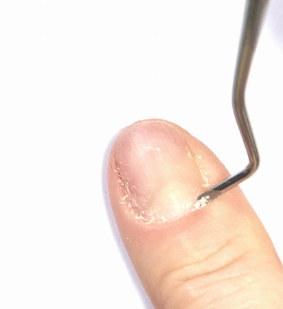 Szpatułka łopatka kopytko, do usuwania skórek przypaznokciowych Nr 201