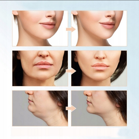 MASAŻER TWARZY , PODBRÓDKA TERAPIA LED 2w1  UJĘDRNIAJĄCY  , POWYSTAWOWY