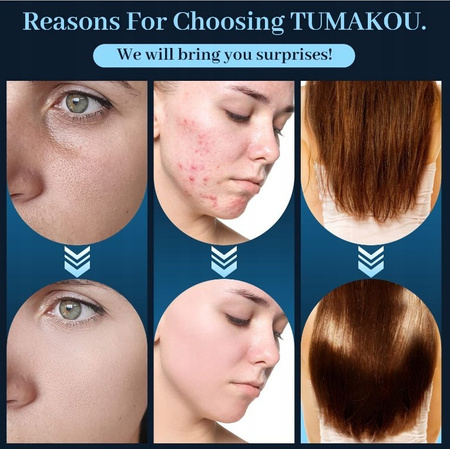 Zestaw do darsonwalizacji Tumkou