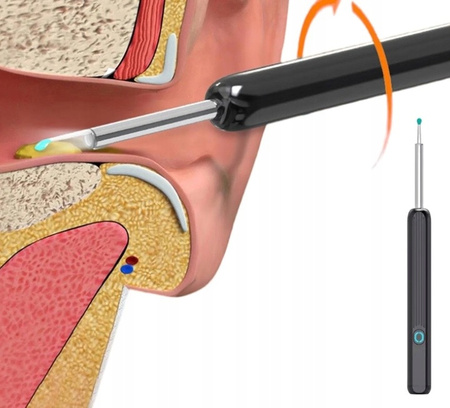 URZĄDZENIE DO CZYSZCZENIA USZU, OTOSKOP KAMERA ENDOSKOPOWA SMART WiFi HD